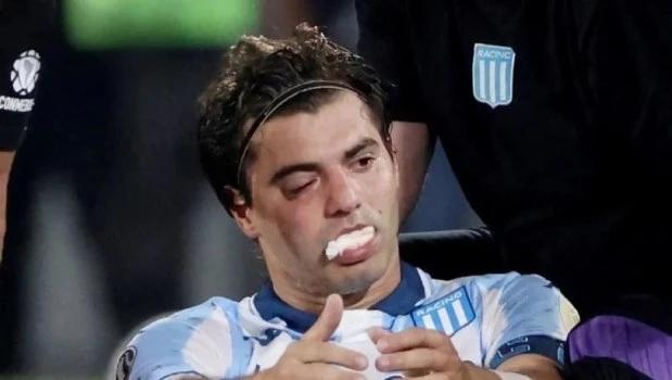 Racing: Santiago Sosa sufrió una fractura en la cara y podría perderse la vuelta contra Flamengo