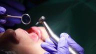 Avance médico sin precedentes podría poner fin a los implantes dentales tal como se conocen