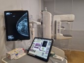 Las turolenses son las aragonesas con más participación en el cribado de cáncer de mama, con un 82,5%