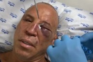 Wanderlei Silva Seeks Justice as Alleged A*sault Costs 180 Days of Boxing Career