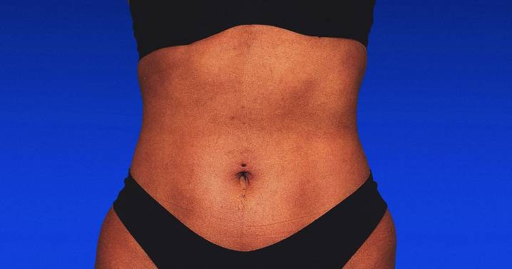 RibXcar ‘Rib Remodeling’ Surgery Review: Before and After