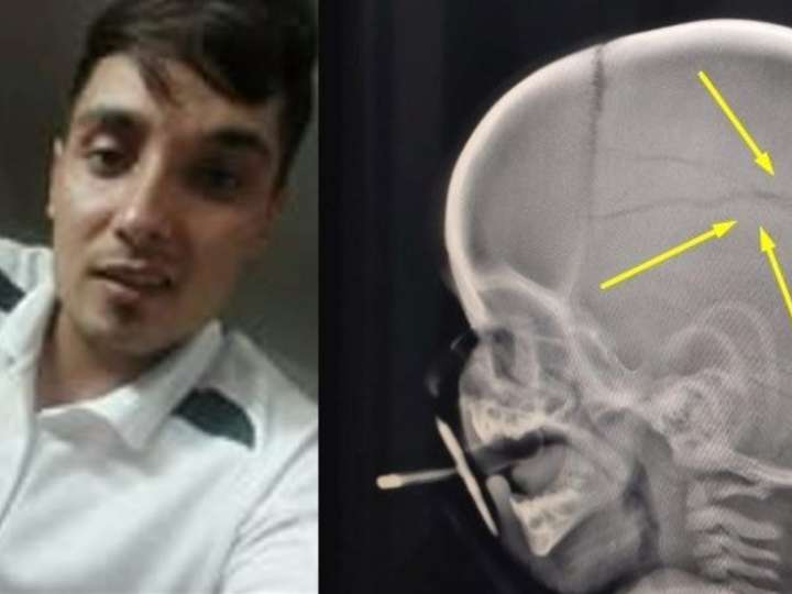 Liberó a un golpeador de niños y lo mandó a un curso de "deconstruyendo masculinidades": volvió a atacar