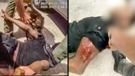 ‘Think We Have the Wrong Guy’: Innocent Black Florida Man Attacked by Cops and Mauled by K9 After ‘Matching the Description,’ Files Lawsuit
