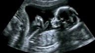 Close One: This Baby Was Almost Born Into Poverty But His Mother Killed Him In The Nick Of Time