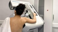 Sanidad solicita a la Junta de Andalucía todos los informes sobre el cribado de cáncer de mama