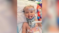 2-year-old defies the odds after spinal cord injury – NBC Chicago