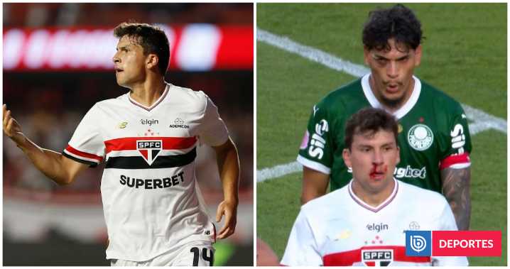 Gonzalo Tapia anota y termina sangrando en Sao Paulo-Palmeiras: segundo gol consecutivo para chileno