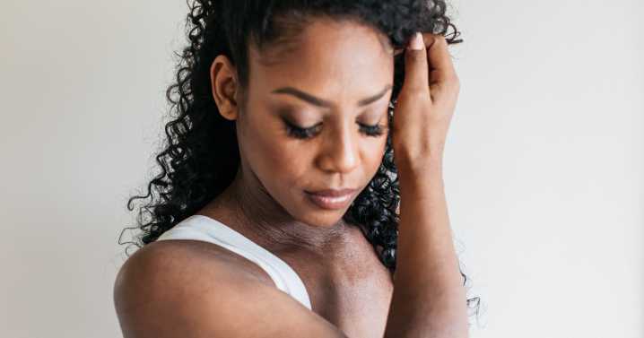 A Dermatologist Rates 7 Viral TikTok Eczema Hacks