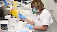 Madrid detecta el primer caso autóctono de viruela del mono de la variante más grave
