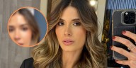 Gabriela Tafur alerta tras sufrir accidente en su rostro mientras estaba en el gimnasio: “Calculé mal”