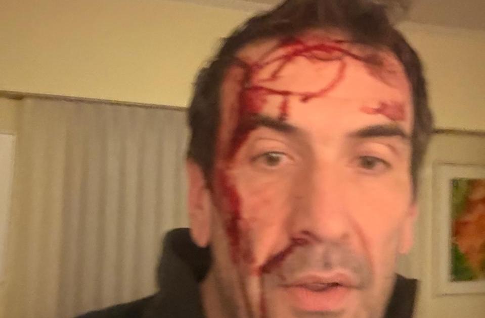 Violento asalto al candidato de LLA, Pablo Cervi: «Neuquén zona liberada. El 101 no funciona»