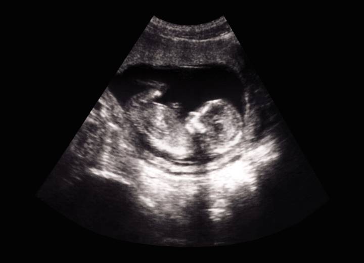 Miraculous ‘Hand of God’ figure turns up in mother’s ultrasound after praying for baby’s health