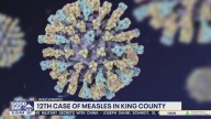 12th case of measles in King County, WA