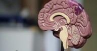Revolución en el diagnóstico temprano: La IA chilena que detecta riesgo de Alzheimer antes de los síntomas