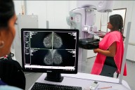 Octubre Rosa: Salud recomienda realizarse controles mamarios anuales para prevenir el cáncer de mama