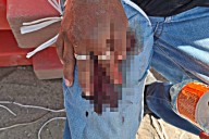 Hombre de 25 años se lesionó con un esmeril, cuando realizaba trabajos en un inmueble de La Paz 
