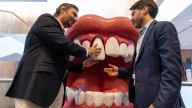El truco que puede salvar tu diente si se cae por un golpe, según los endodoncistas
