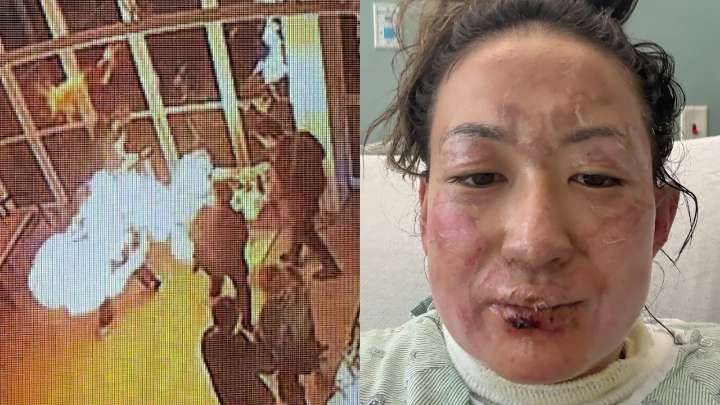 Video shows 'fireball' incident at Navy Pier restaurant that left woman critically injured; lawsuits filed