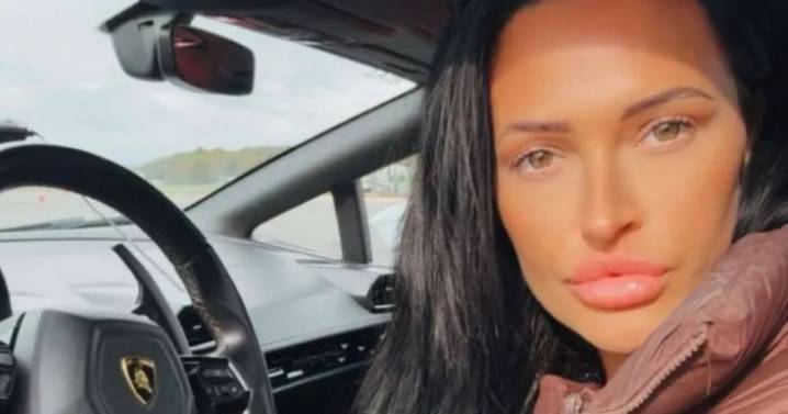 I'm a DWP benefits influencer - life includes supercars, Botox, £600 Flamingo Land trips
