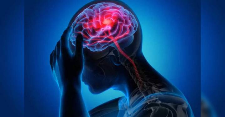 79% rise in brain stroke cases in state in 2024