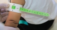 Por qué el hambre afecta a tu salud... y también a la de tus descendientes