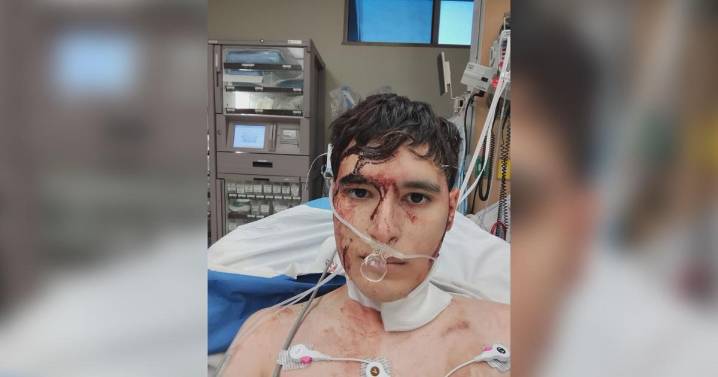 Tucson man recounts Greyhound bus stabbing