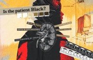 Is the Patient Black? Check this Box for Yes