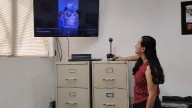 Realizan por primera vez una cirugía vascular en hospital de segundo nivel de Ciudad Madero