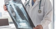 CHRISTOPHER BUCKTIN: Meth-addled Florida man's X-ray raises more questions than answers