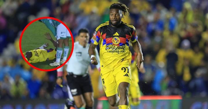 ¡Otra baja! Allan Saint-Maximin sufre dolorosa lesión tras una patada en el América vs Santos (VIDEO)