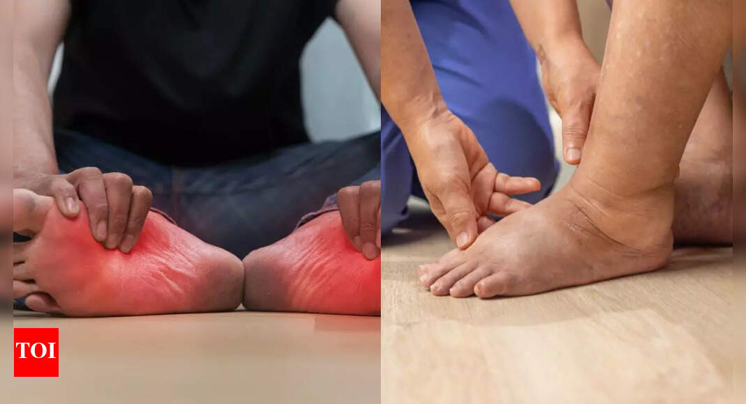 Early symptoms of lung cancer that show up in your legs and feet: Swelling, pain, and colour changes to watch for