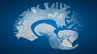 Study finds male brains may shrink faster than female brains with age