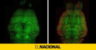 Revierten el Alzheimer en ratones con tres inyecciones de nanopartículas