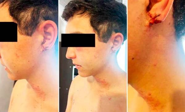 "Me sacó la oreja": el testimonio del joven torturado por sus jefes en una estancia