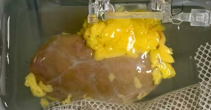 Científicos crean riñón universal que concuerda con cualquier tipo de sangre