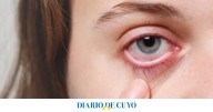 El grave error que casi deja ciega a una joven: se duchó con lentes de contacto