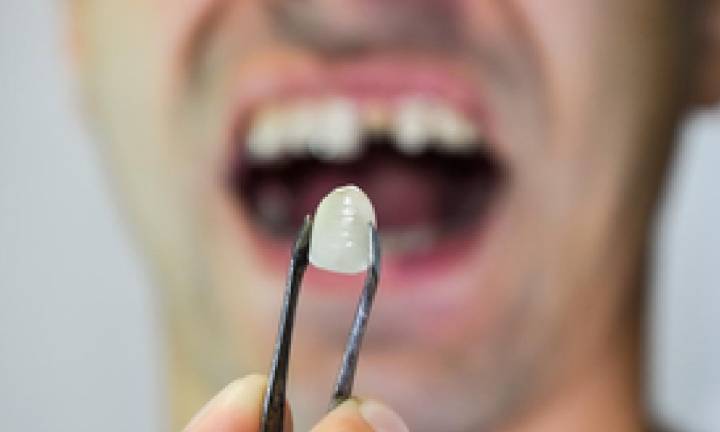 Why is it so shameful to have missing or damaged teeth?