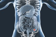 Speed vs. Certainty When it Comes to Expedited Regulatory Review of Colorectal Cancer Therapeutics