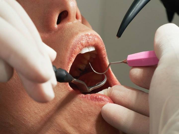 Thousands erroneously approved for dental coverage: Health Canada