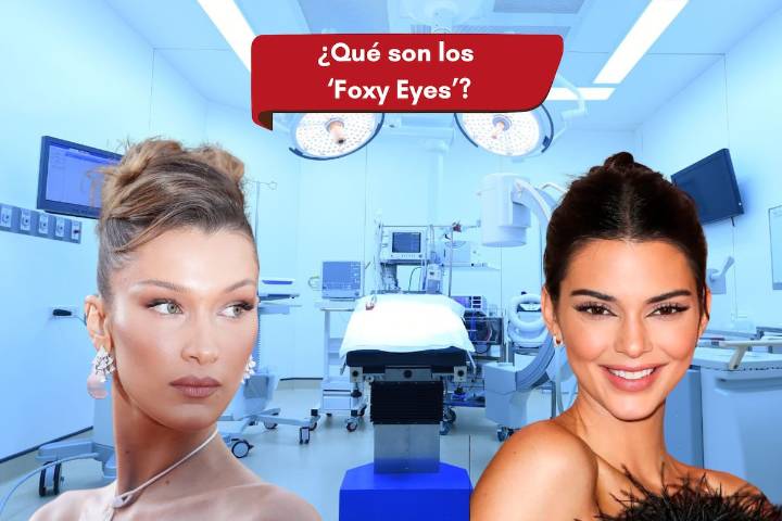 Hilos tensores y Foxy Eyes: qué es, cuánto cuesta y por qué puede ser peligroso