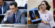 "La teta de Anabel" antes de la Oreja de Van Gogh: una mamografía en el Parlamento andaluz rompe el escudo de Moreno para la crisis de los cribados