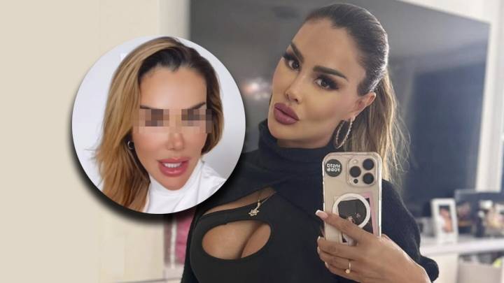Ninel Conde cambia el color de sus ojos a verde olivo con riesgoso procedimiento