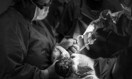 Researchers find surgical technique reduced risk of early preterm birth for patients with cervical...