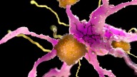 New Alzheimer's Treatment Clears Plaques From Brains of Mice Within Hours