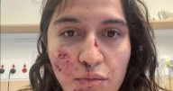 Horror as mad magpie attacks woman and leaves her with broken neck