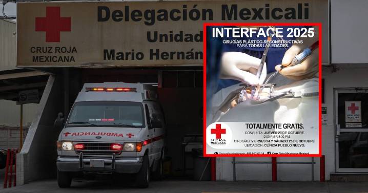 Un acto de humanidad: Cruz Roja invita a jornada gratuita de cirugías reconstructivas