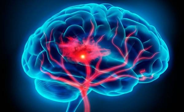 En el Día Mundial del ACV, Formosa lanzó una capacitación clave para detectar a tiempo