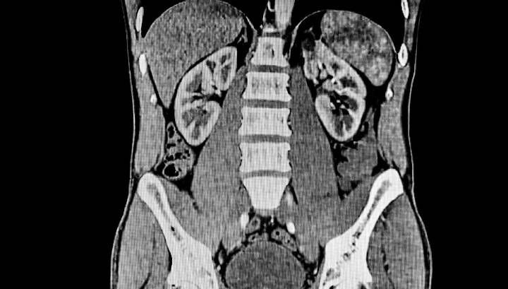 ‘Hay una importante error de… estudios’