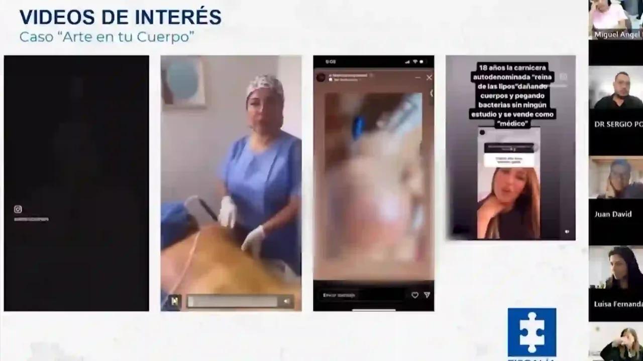 Falsas cirujanas que desfiguraron a 24 mujeres en Medellín tenían deudas con la justicia