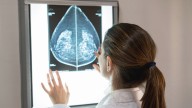 Fiscalía investigará los fallos en el cribado de cáncer de mama en Andalucía